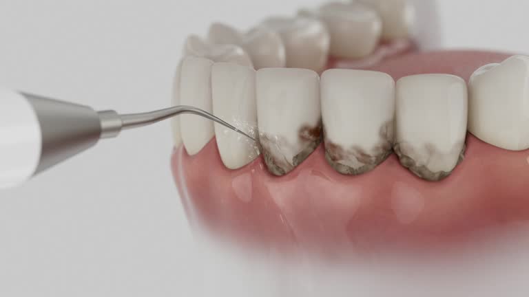 Trusted Dental Implants service in Aetna Estates, CO - Dentist Open Now